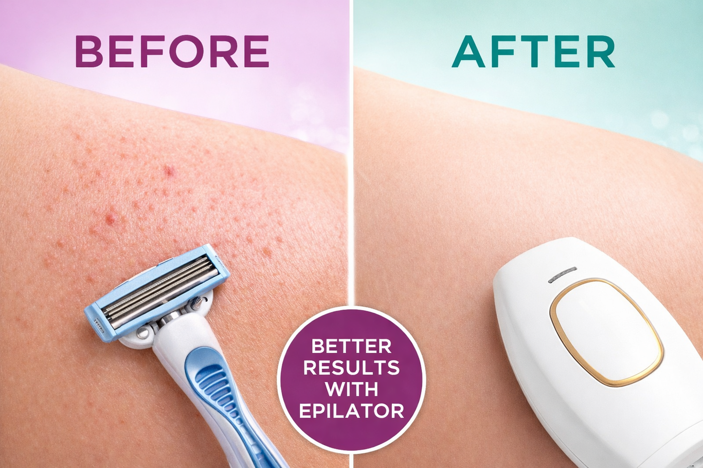 🖤 Laser Hair Pro™ IPL Haarentfernung für Zuhause