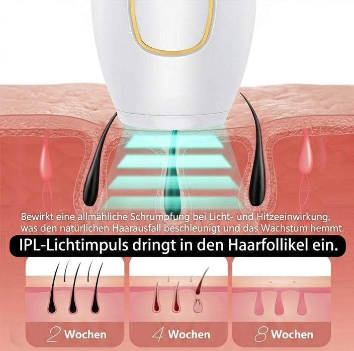 🖤 Laser Hair Pro™ IPL Haarentfernung für Zuhause